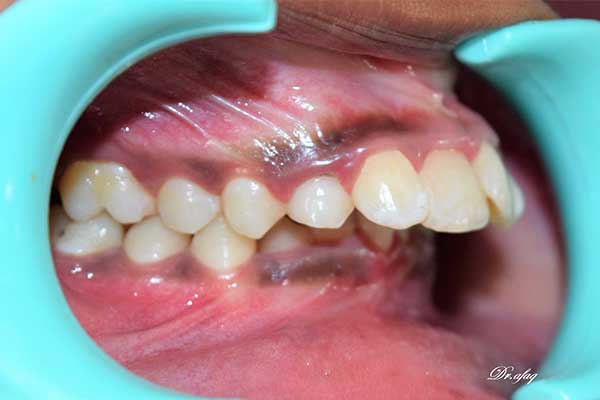 Zaara Dental Clinic in Madurai, Dental Clinic in Madurai, Dental Hospital in Madurai, Dentist Madurai, Dental Hospital in Madurai, Dentist in Madurai, Best Dentist in Madurai, Teeth Clip Treatment, Tooth Pain Treatment in Madurai, Dental Clinic in Madurai, Teeth Clinic in Madurai, Tooth Hospital in Madurai, Top Dentist in Madurai, Tooth Clip Treatment in Madurai, Tooth Cleaning in Madurai,Teeth Removal in Madurai, Top 10 Dental in Madurai, Top 10 Dentist in Madurai, Best Dental Clinic in Madurai